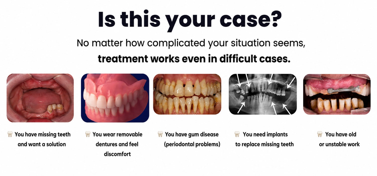 Is this your case?