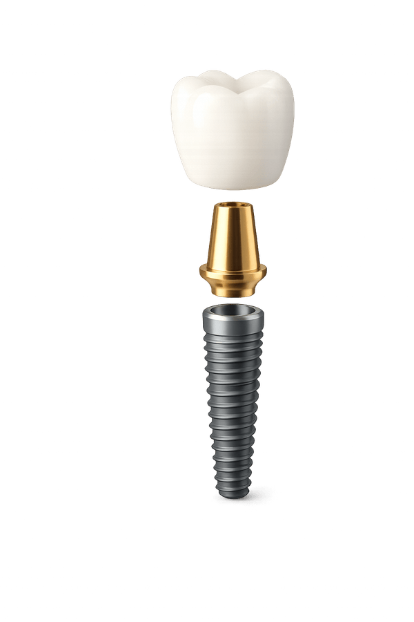 Estructura de un implante dental